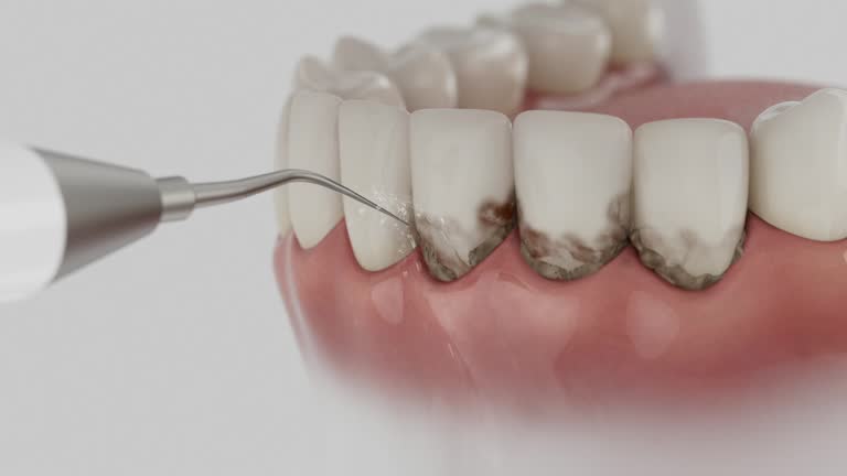Trusted Emergency Dentist service in St. Andrews, SC - Dentist Open Now